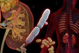 Urinary tract infection in nigeria