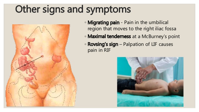 appendicitis
