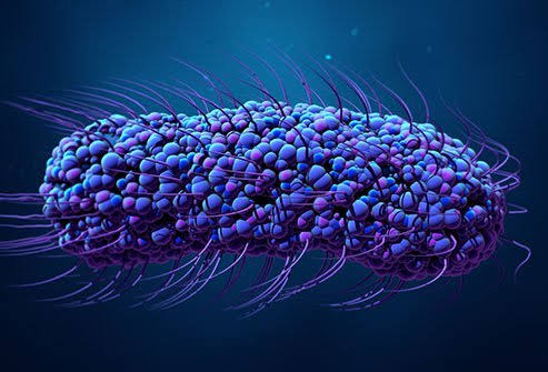 Typhoid feve